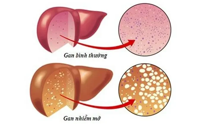 Chức năng chính của gan